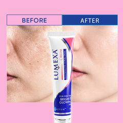 Lumexa Cream - Skin Brightening