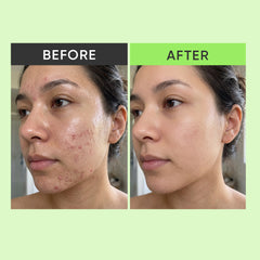 Mazclarity Micellar Foaming Facewash