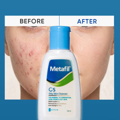 Metafil OS Oil Control Cleanser