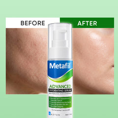 Metafil Hydrating Serum