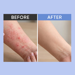 Zarnol Anti-Itch Lotion