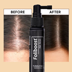 Foliboost Hair Serum