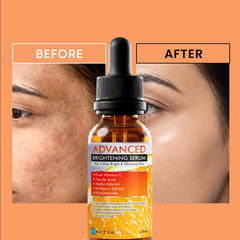 Lumexa Skin Brightening Serum