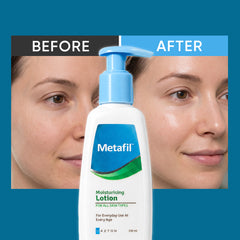 Metafil Moisturising Lotion