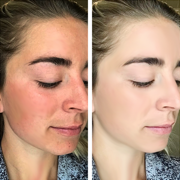 Sun Protection – Mazton Skin Solutions